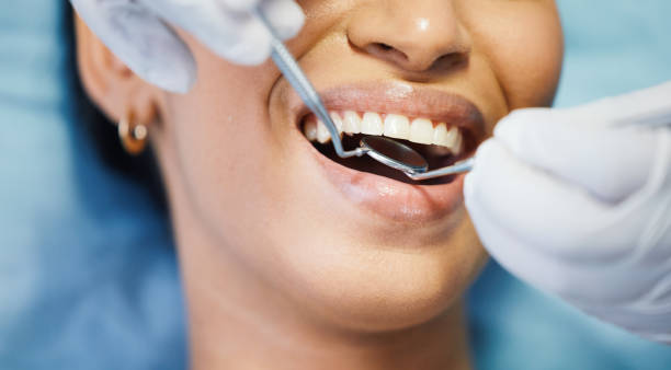 Best Broken or Chipped Tooth Repair in Franklin Park, IL